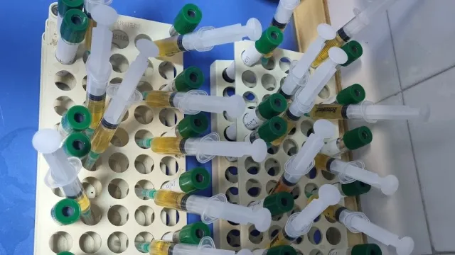 PRP, Eksozom ve Kök Hücre Tedavileri Ne Kadar Etkili?