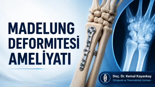 Madelung Deformitesi Ameliyatı
