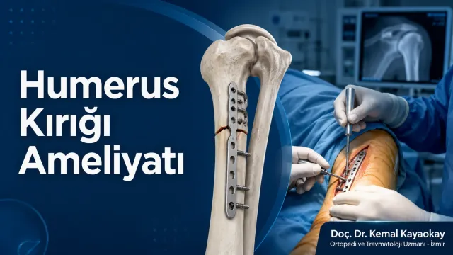 Humerus kırığı ameliyatı