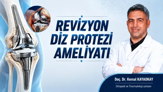 Revizyon diz protezi İzmir